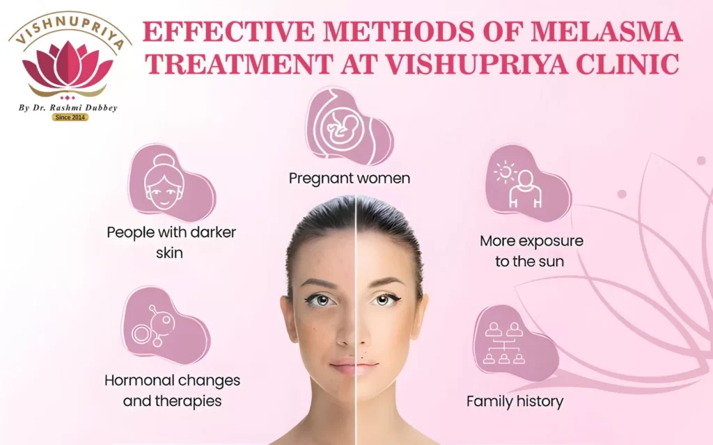 Melasma-treatment