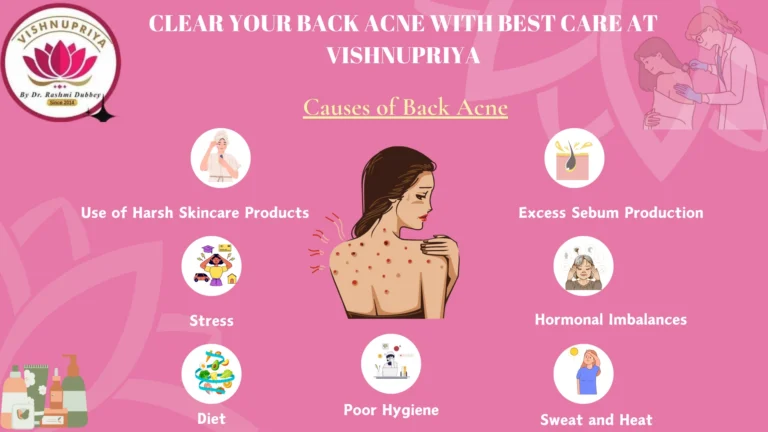 Back Acne