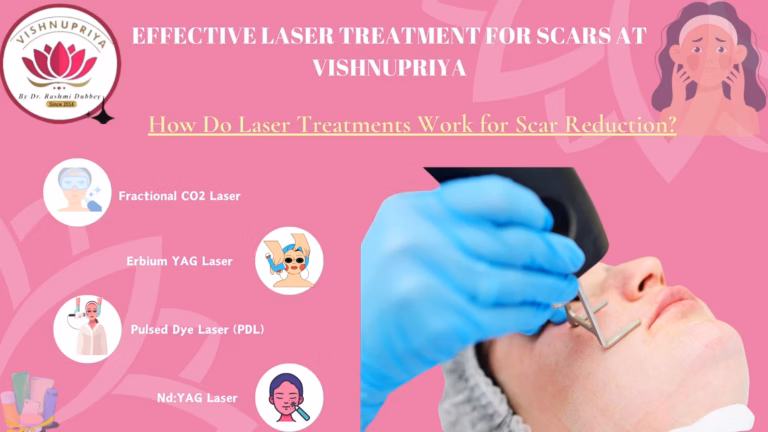 Laser Treatment for Scars