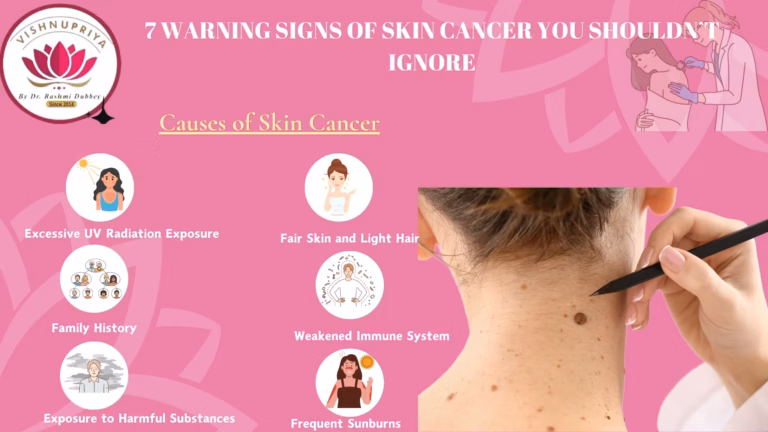 Skin Cancer