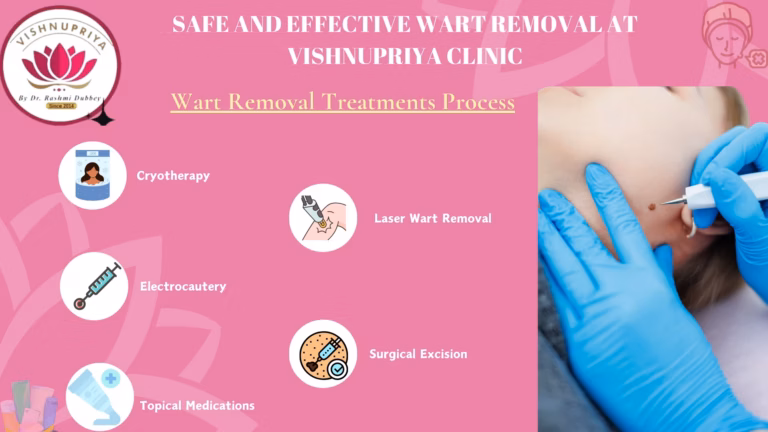 Wart Removal