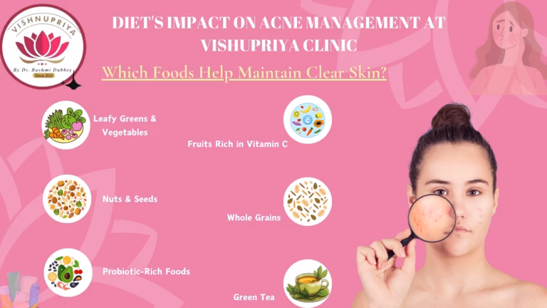 Acne Management