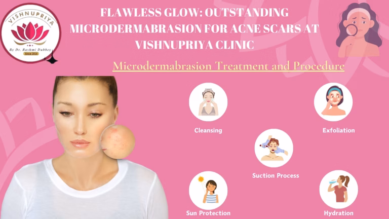 Microdermabrasion for Acne Scars