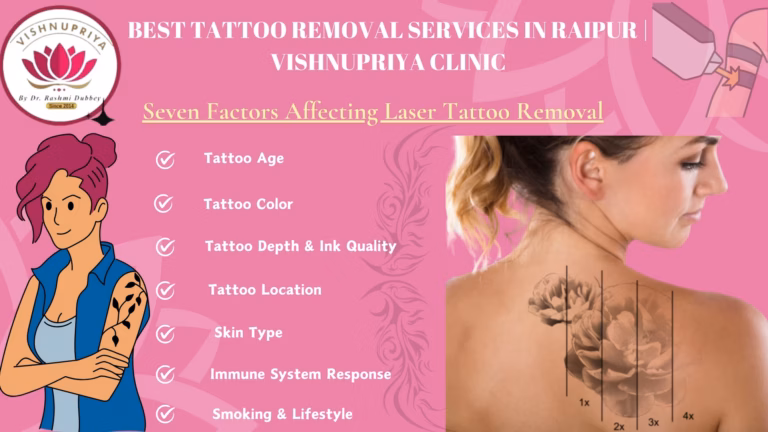 Tattoo Removal
