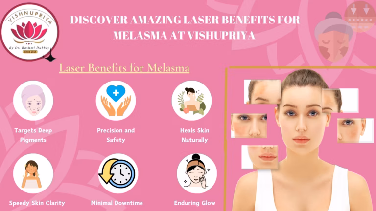 Laser Benefits for Melasma