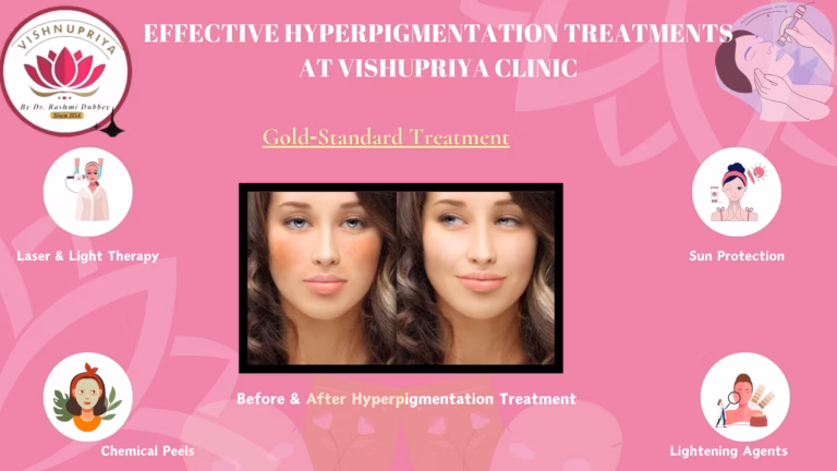 Hyperpigmentation