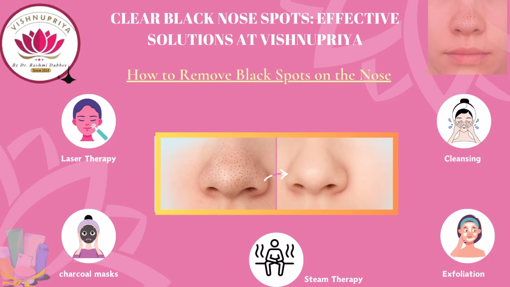Black Nose Spots