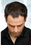 Dry & Damaged Hair Repair after