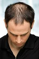 Dry & Damaged Hair Repair before