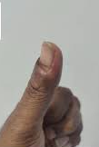  after treatment