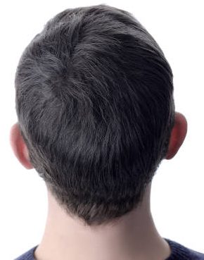 Oily Scalp Treatment after