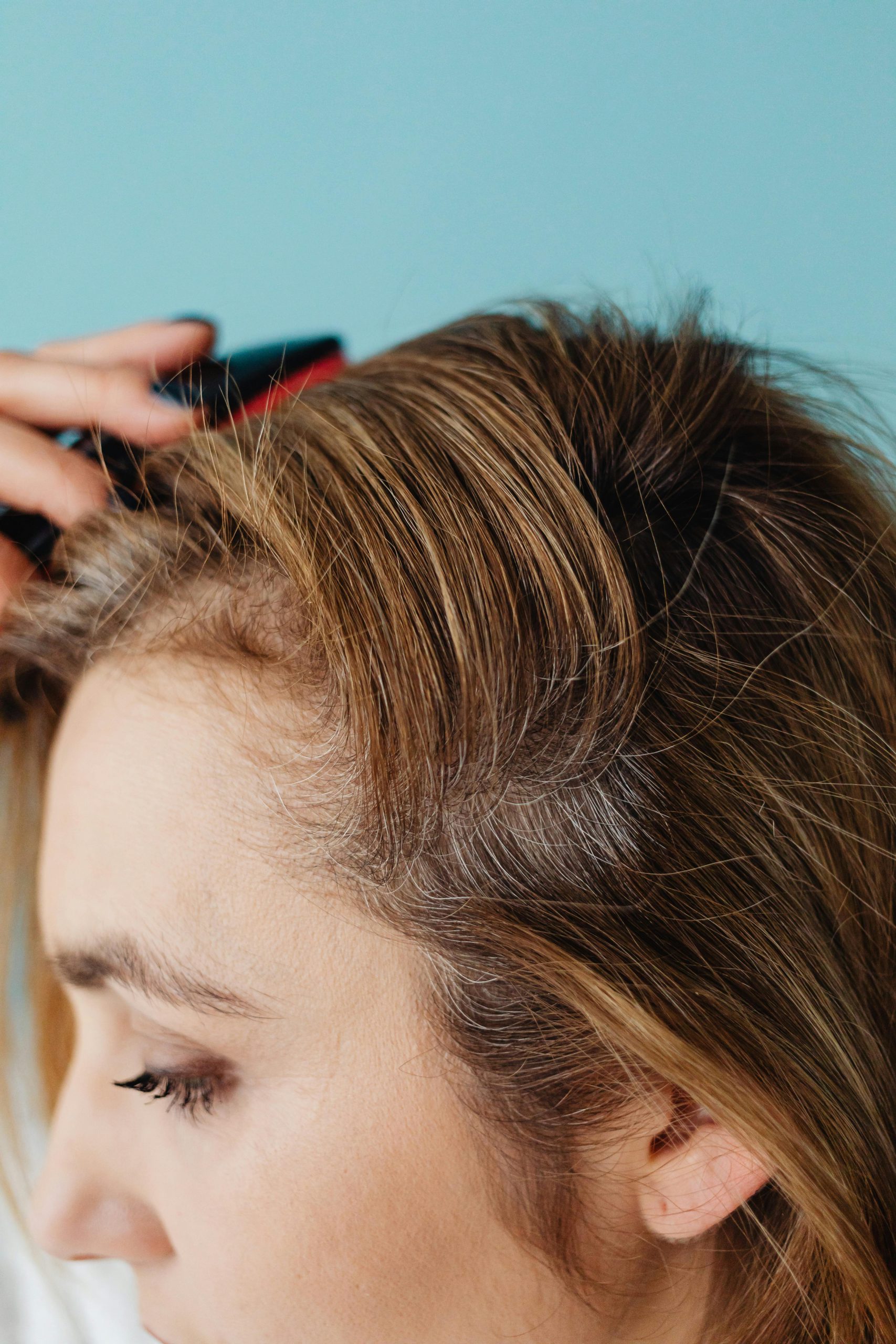 Dandruff & Scalp Care after