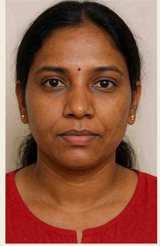 Pigmentation Removal before